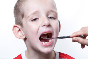 child-dental-cavity